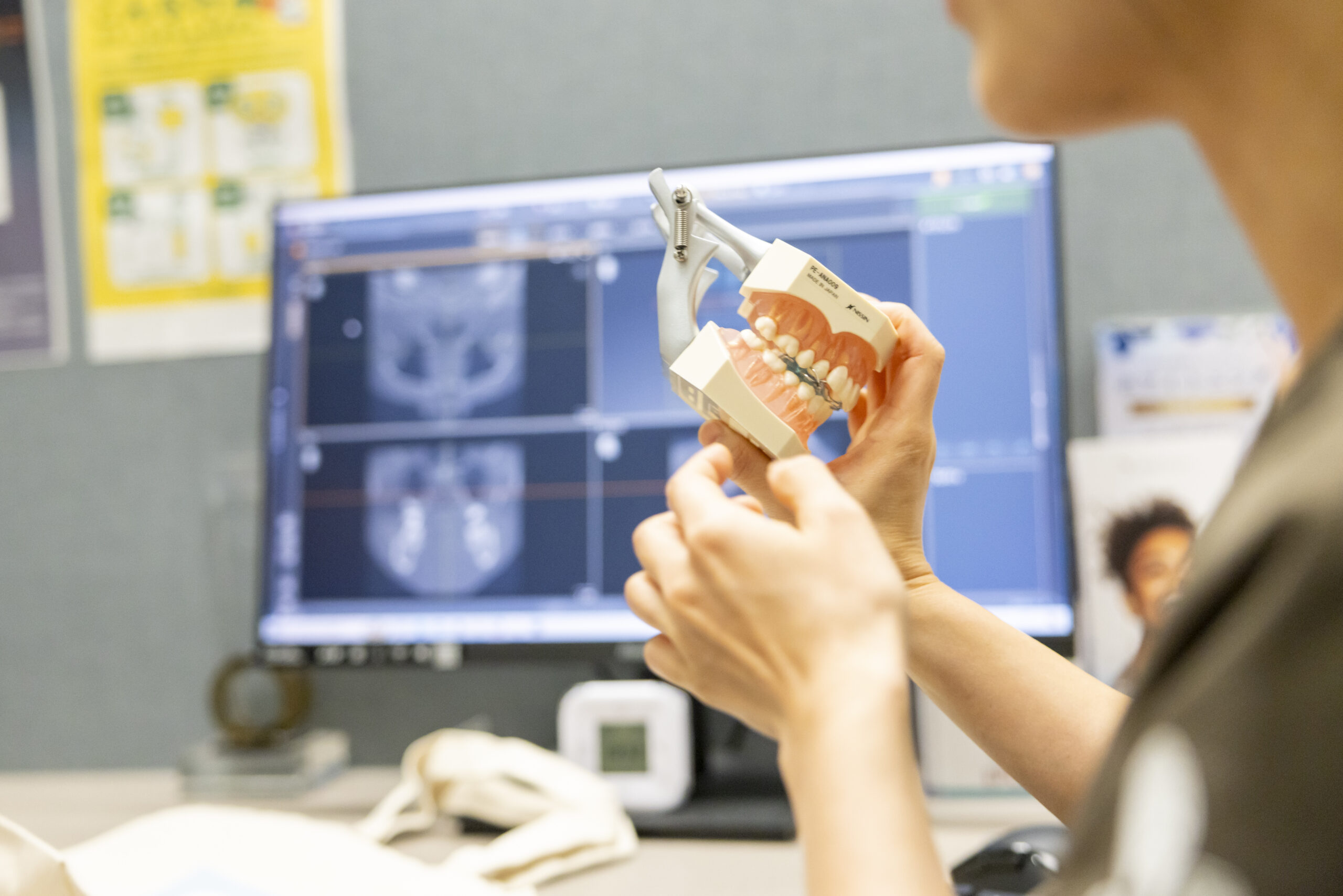 将来の抜歯リスクを減らせる理由