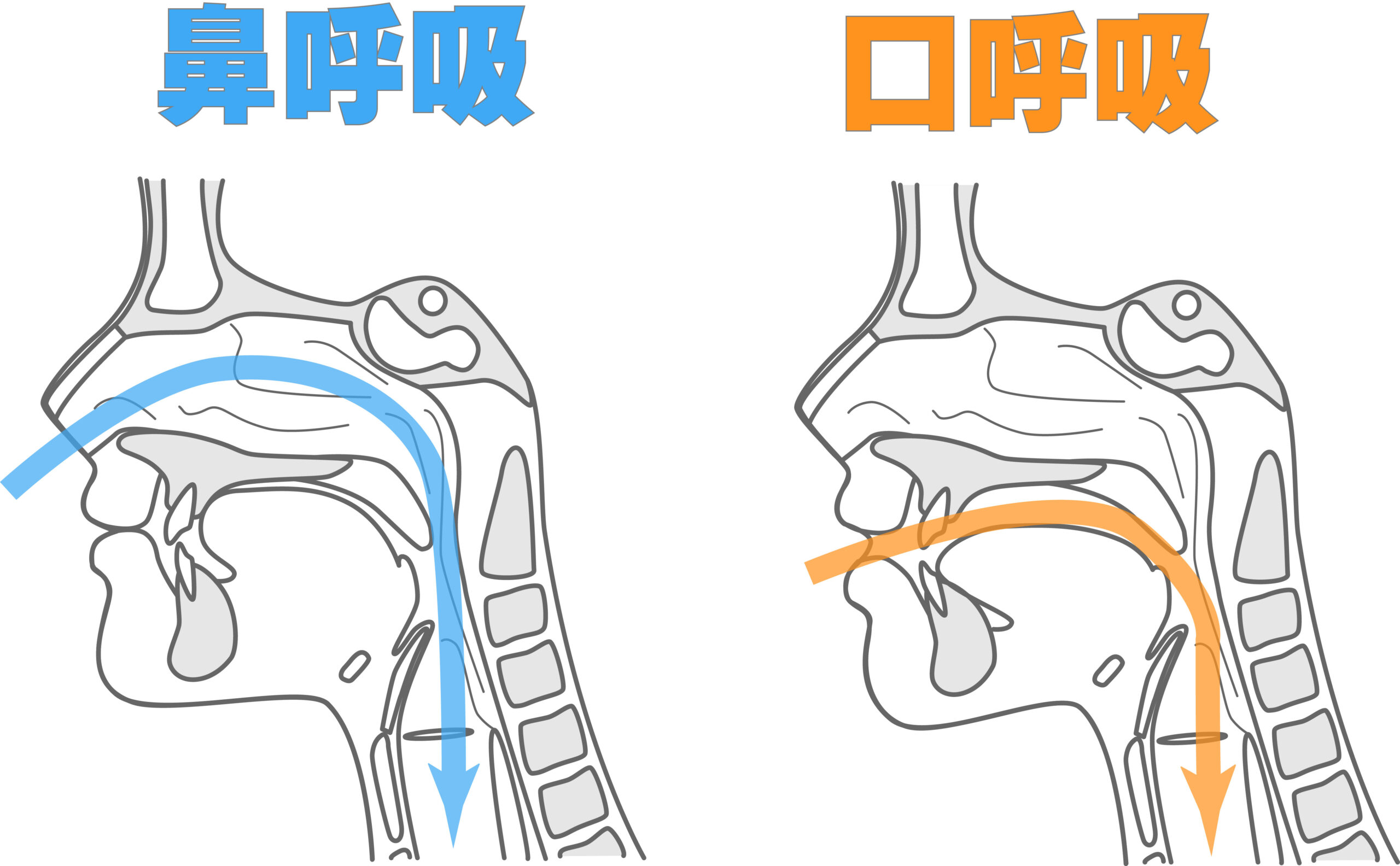 歯並びと睡眠時無呼吸症候群の関係